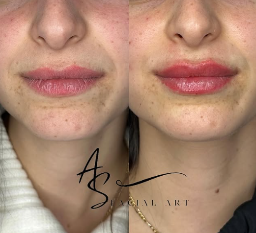 שני צילומי שפתיים עם סימן המים AS Facial Art, ללא שינוי בסדר התמונות